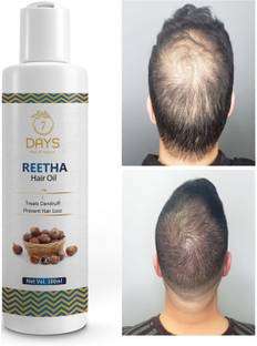 7 Days Cold-Pressed 100% Pure Reetha Oil paraben free for hair regrowth hair fall Hair Oil