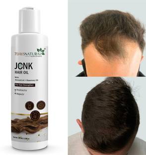7days natural oil Fast Result for hair Regrowth |Anti hair fall | Anti Dandruff Hair Oil