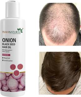 7days natural Oil With Black seed stop hair loss | anti hair |fall dandruff Hair Oil
