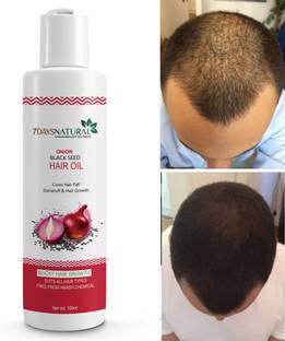 7days natural Onion Hair Growth Oil for Stronger Roots and Accelerated Hair Growth Hair Oil