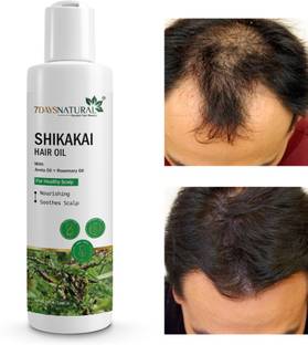 7 Days Natural Shikakai dandruff control & roots regeneration Hair Oil