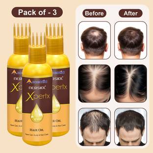 Nersiol Xpertx |Controls Hair Fall, Boosts Growth |With Bhringraj, Rosemary & Kalonji | Hair Oil