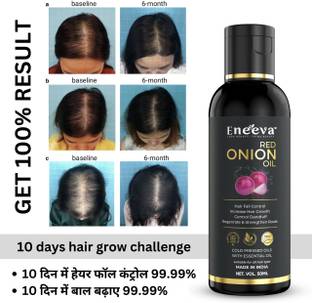 eneeva Red onion hair oil Hair Oil