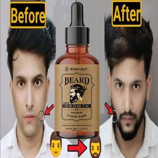 Rosevely BBeard and Hair Growth Oil -30ml for faster beard growth & thicker looking beard Hair Oil
