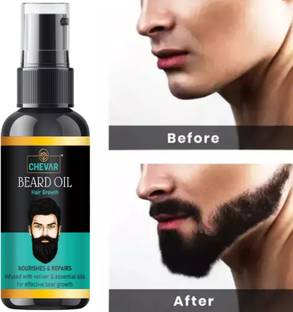 Chevar beard oil Advance Beard Growth Oil- For Patchy & Faster Beard Growth  Hair Oil
