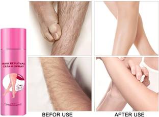 Latixmat bal saaf karne wala cream Spray