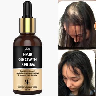 INTIMIFY Hair Growth Serum with Saw Palmetto, Redensyl, Procapil, Hair fall control
