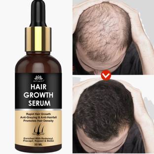 INTIMIFY Hair Growth Serum For Hair Fall Control & Growth For Women & Men