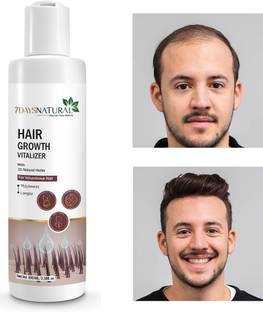 7 Days Hair Vitalizing Serum