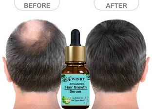 winry Hair Growth | Increases Thickness Hair Serum