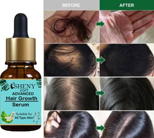 sheny soft ALL HAIR TYPE SERUM (Advanced hair growth serum) (30 ml)