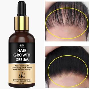 INTIMIFY Hair Growth Serum For Promoting Hair Growth & Controlling Hair Fall