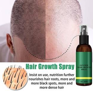 Jiwoo Hair Growth Spray - Extra Strength Professional for Hair Loss