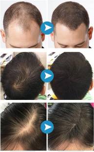 ADJD Thickener Spray bald spot cover Hair Spray