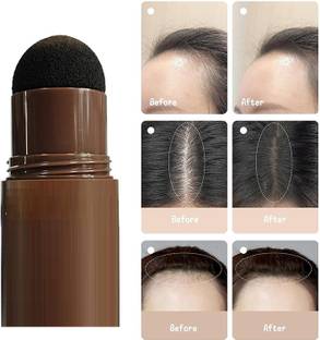 MYEONG Hair Fibers for Thinning Hair and Bald Spots - Temporary Hair Loss Concealer 10 g