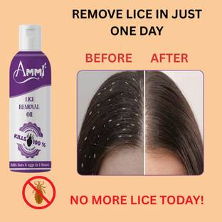 Ammi Lice Removal Oil 100g | Eliminates Lice, Nits & Eggs | Herbal Solution