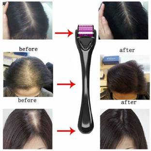 SIYDHA Best Derma Roller 0.5 Mm Scalp Massager For Beard & Hair Growth