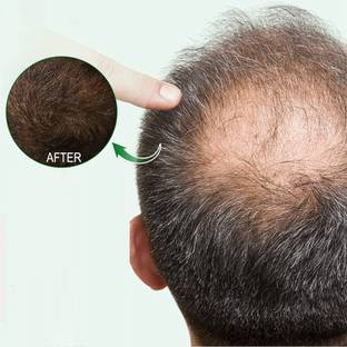 Latixmat ALOEVERA Herbal Vitamin -E Hair Capsule For Damage Repair ,Anti Hair Fall