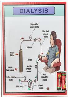 MELODY's MODEL OF DIALYSIS Working Science Model For School Project .