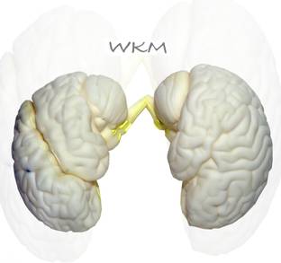 wkm 3D Human Brain Model Structure Life Size Anatomy Removable in 3 Parts