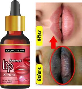 Top Quality Store Beetroot Lip Brightening & Hydrating Serum Reduces Dark Patches Remover