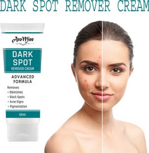 AroMine Dark Spot Corrector Cream, Pimple Clear Cream, Acne Scar Removal For