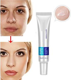 YAWI Skin Acne rejuvenation & cream Oil Control/Shrink Pores/Acne Scar Remove