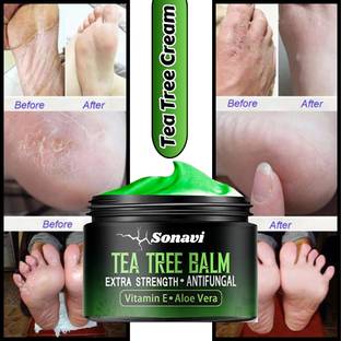 Sonavi crack heel repair cream Smooth Foot Crack Cracked Heel Repair Foot Cream