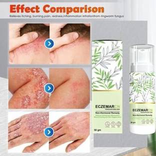 LootZoo Eczemaron for Ringworm, itching, Eczema & Fungal Infection Anti Fungal Cream