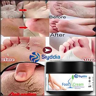 SIYDDIA Crack Cream For Cracked ,Dry & Dehydrated Skin-50g