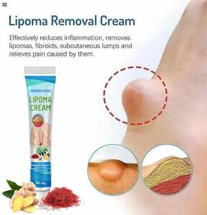 INDIANA HUDA Herbal Lipoma Removal Lotion 30g | Smooths Out Fat Lumps