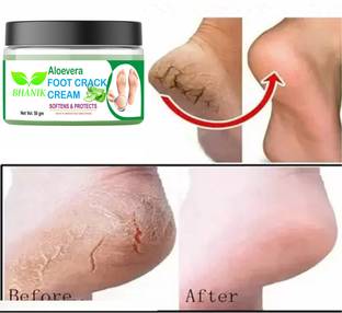 BHANIK aloevera feet crack heel repair cream Smooth Foot