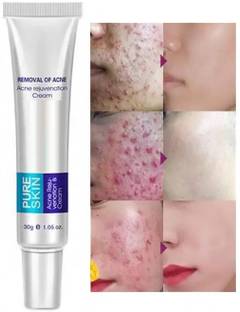 MYEONG pigmentation Cream Acne Scar Removal Cream