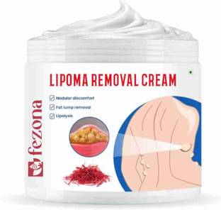 FEZONA Lipoma Removal Cream - Lipolysis - Fat Lump Remover 100 gm