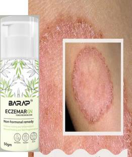 barap eczemaron anti fungal Clear Skin Fast with Ecz Anti-Fungal Cream Boost amar