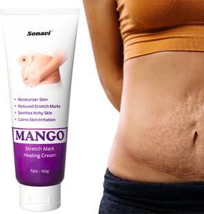 Sonavi Pregnancy Stretch Mark Cream Moisturises & Soothens Skin for women