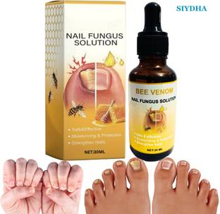 SIYDHA Nail Fungal Treatment Serum – Strengthen And Protect Naturally