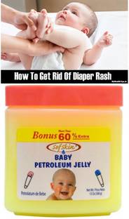 Sofskin Baby Petroleum Jelly (Anti Diaper Rash) 368 gm