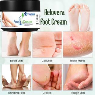 SIYDDIA Feet Crack Heel Repair Cream for Moisturizes and Smooth Feet