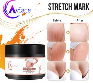 Aviate Stretch Marks Removal Cream, Goodness of Shea Butter, Saffron FOR WOMEN