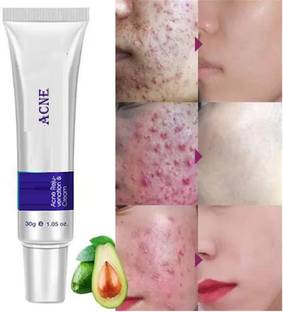 Latixmat Face Skin Care Acne Anti-Wrinkle Treatment Removal Cream Spots Scar