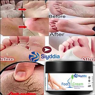 SIYDDIA Crack Cream For Cracked ,Dry & Dehydrated Skin-50g