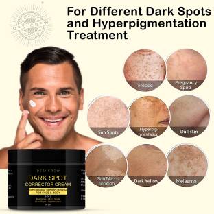 Desi Crew Dark Spot Remover Cream, Pimple Marks, Acne Scar, Pigmentation