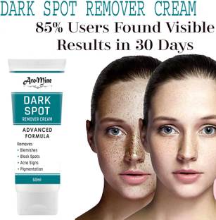 AroMine Dark Spot Remover Cream For Remove Pimple Marks, Acne Scar Blemishes