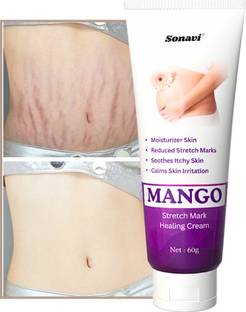 Sonavi Stretch Marks Remover, Remove Scar & Marks Cream