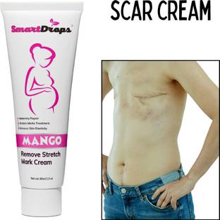 smartdrops Stretch Mark Cream For Scars, Ageing, Firming Body Cream for All Skin Type