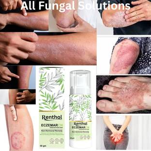 Renthol Eczemaron Anti Fungal Cream For Men & Women (50 g)