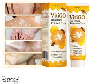 ACTIWOW Vitigo Bee Venom Cream for Puffy Skin Areas X001