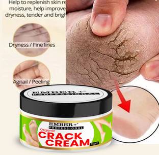 Ember Foot Cream For Rough, Dry and Cracked Heel, Feet Cream For Heel Repair
