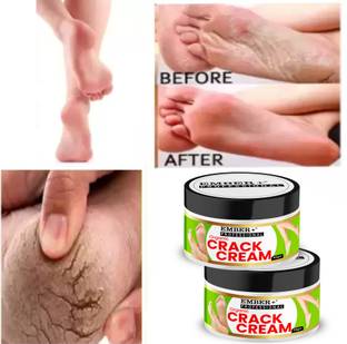 Ember Cream For Rough, Dry and Cracked Heel And Hand, Feet And Hand Cream For Healing